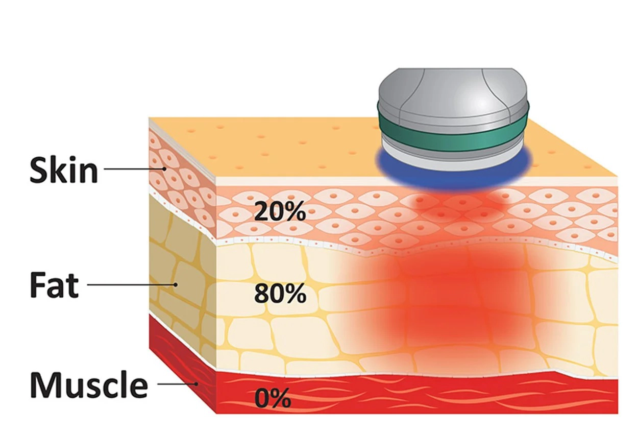 2.45GHz Penetrating Heating Technology